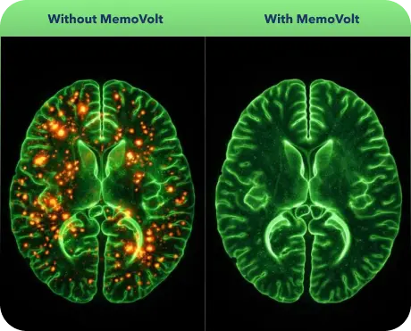 Brain fog before and mental clarity after taking MemoVolt for 60 days